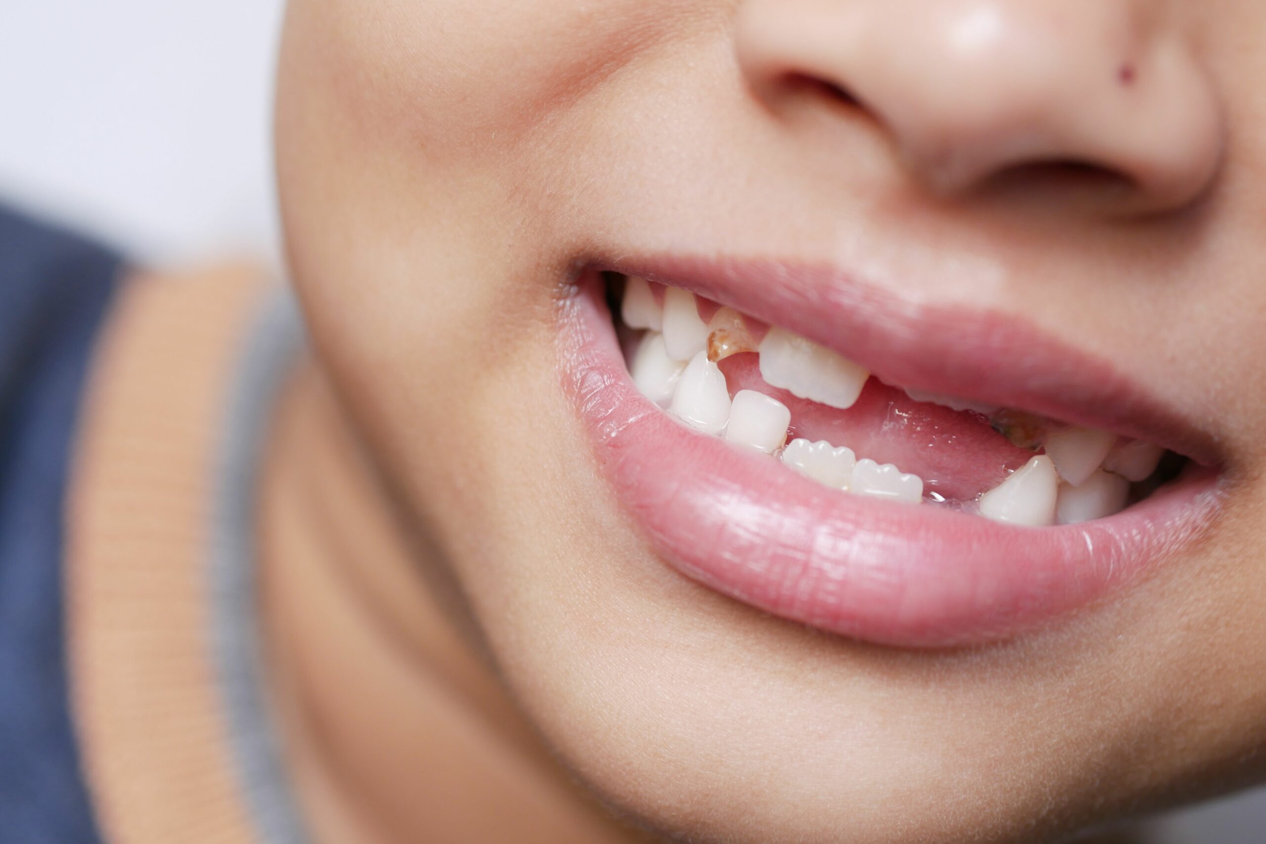 Gros plan sur la bouche et les dents
